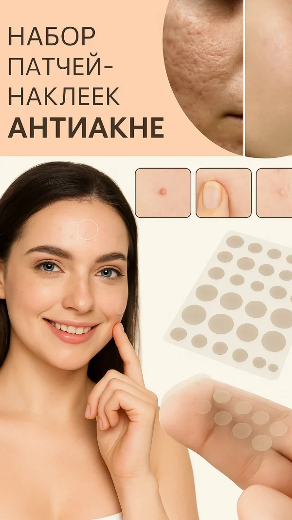 Патчи наклейки от прыщей акне рубцов 80шт